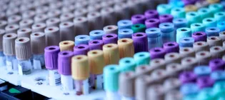 Close up photo of small green, pink and purple plastic 'Vacutainer' tubes filled with blood for testing in a lab